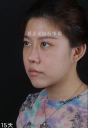 -北京米扬丽格医疗美容·联合丽格鼻整形中心