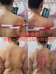 -丽减美瘦吧·减肥瘦身