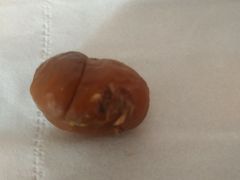 -二斗栗子(西湖道店)