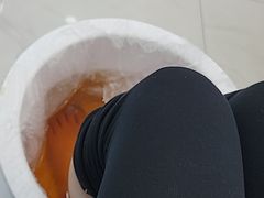 -Andrew指甲专科灰指甲·甲沟炎矫正·3D步态矫形鞋垫定制(浦三路店)