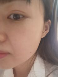 -苑苑vbeauty科技美容SPA