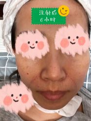 -新美荟医美·专注面部美学抗衰