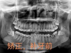 -团圆口腔·种植中心(锦江院区)