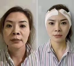 -西安壹加壹医疗美容·西北抗衰旗舰店