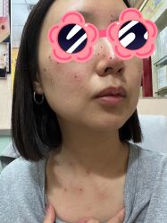 -北京美痣堂古方祛痣斑疣瘊