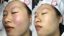 -Cream88颜皮肤管理中心