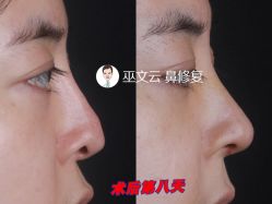 -北京米扬丽格医疗美容·联合丽格鼻整形中心