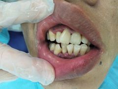 -微笑牙科口腔(三亚迎宾院区)