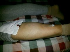 -中医推拿(永兴佳园店)