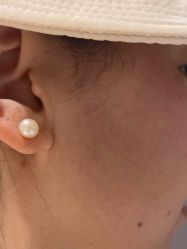 点击看大图 体验后-BR光电保养