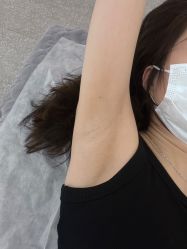 -MUSES专业脱毛比基尼サロン日式连锁