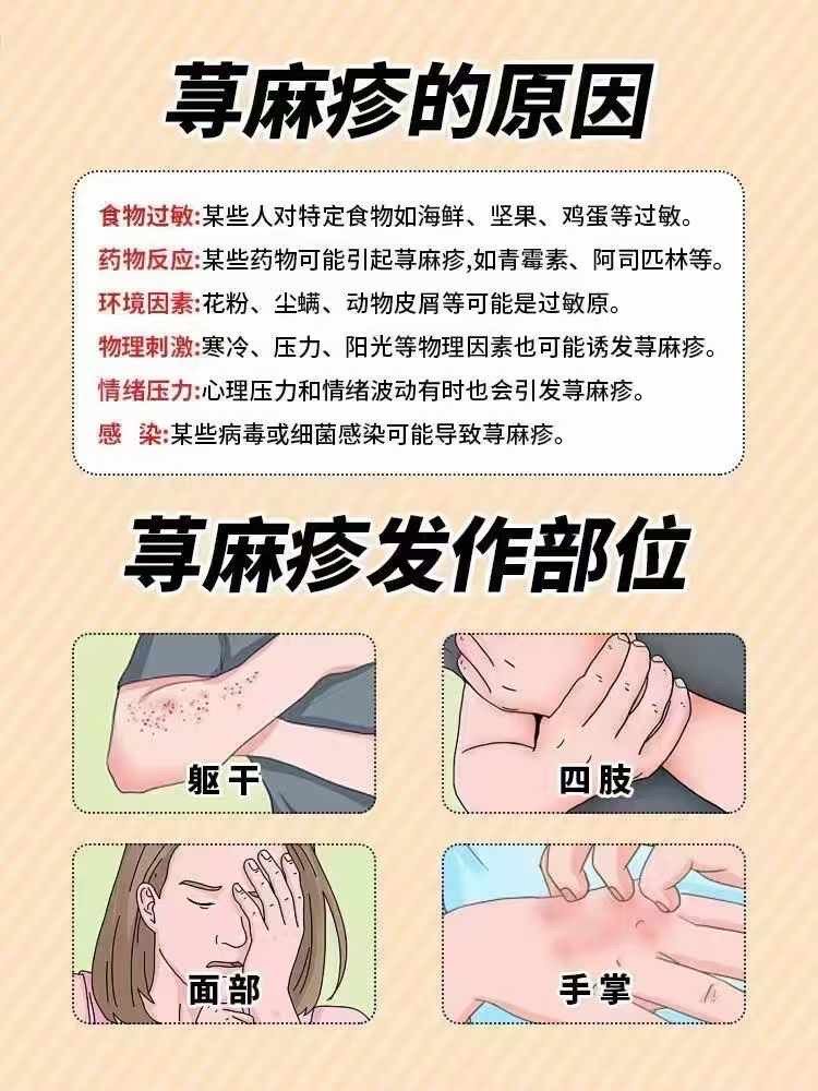 寻麻疹怎样引起的