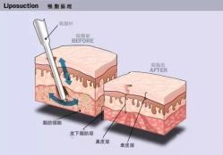 -上海漾颜医疗美容