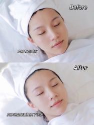 -美肤盾祛痘·问题肌头疗管理中心