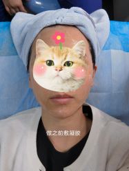 -小忠丽格医美