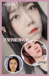 -Yestar艺星医疗美容医院