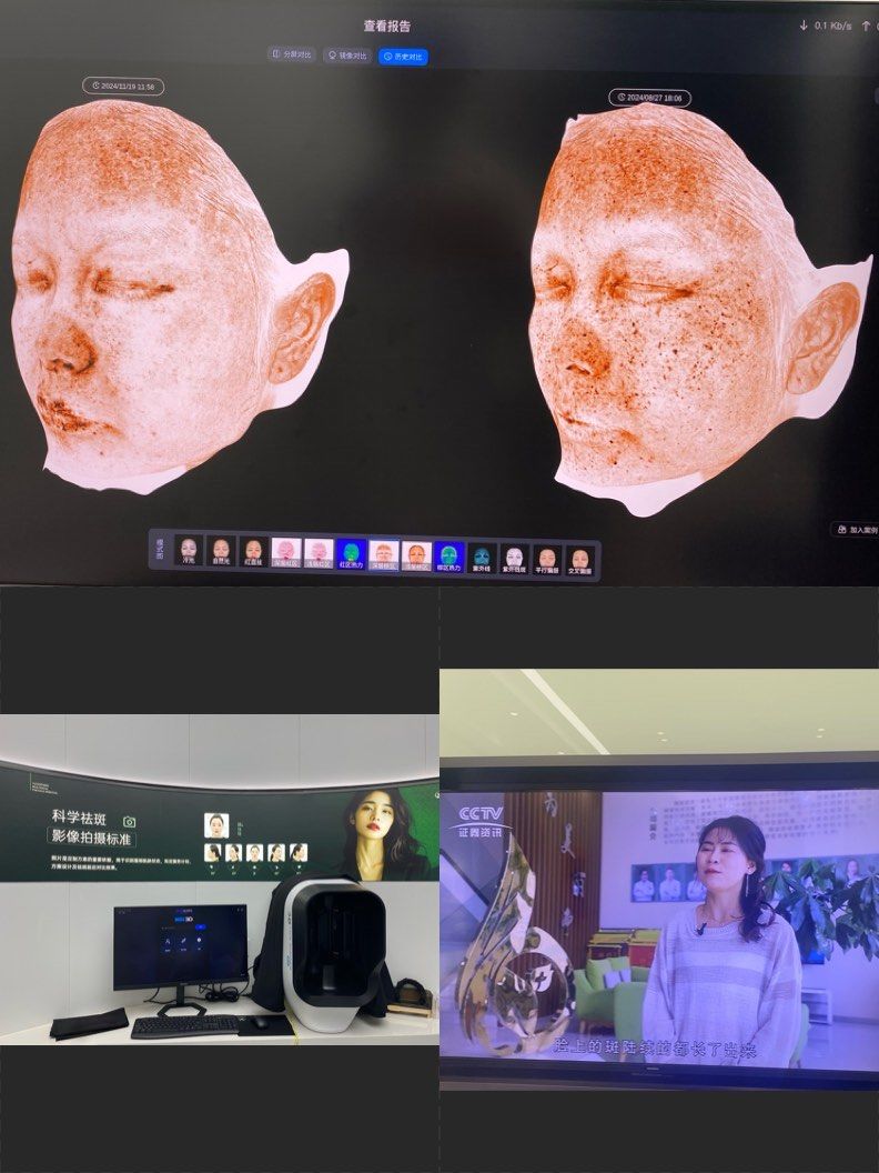 原来玉林御研堂也有这么专业的皮肤检测仪!