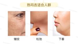 -北京米扬丽格医疗美容·联合丽格鼻整形中心