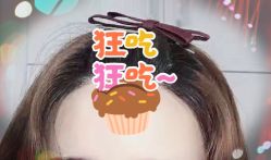 -大麦微针植发全国连锁