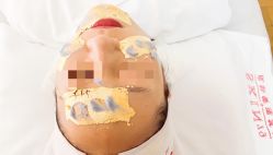 -skin79皮肤管理基站
