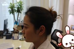 -大麦微针植发丨全国连锁