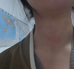 -首都儿科研究所附属儿童医院