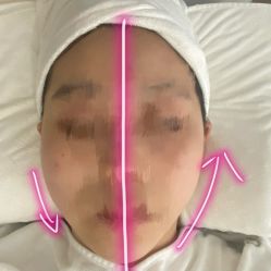 -海菲秀黑钻·SELF SKIN悦己·Tech SPA