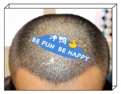 -大麦微针植发全国连锁