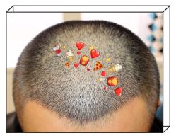 -大麦微针植发全国连锁