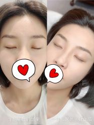 -MIVI半永久纹眉绣眉