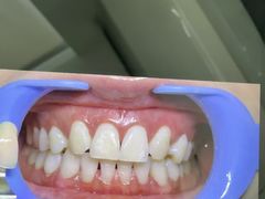 -极光口腔·矫正种植修复(锦江院区)