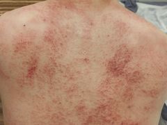-艾之灸养生馆·推拿·艾灸