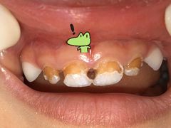 -极橙儿童齿科矫正中心(奥城店)