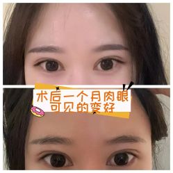 -素美医疗美容·西南眼鼻整形·修复基地