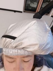 -大麦微针植发全国连锁