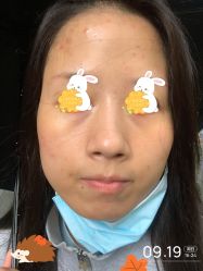 体验前-圣嘉新医疗美容医院