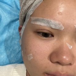 体验前-星和深湾荟医疗美容