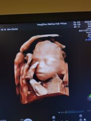 -杭州贝瑞斯美华妇儿医院·早孕·产检·儿科