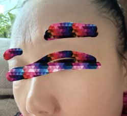 -澳尔颜选医疗美容