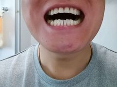 -爱贝口腔·牙周诊疗·种植修复中心