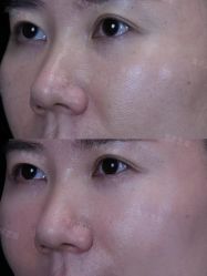 -Yestar重庆艺星医疗美容医院
