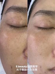 点击看大图 -E.beauty驻颜·痘敏肌调理中心