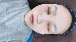 体验后-洁铭新加坡医美