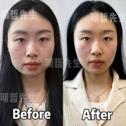 -颜和骨正·明哲式骨相美学整骨