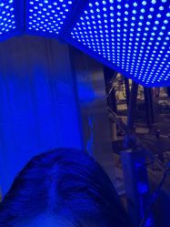 -碧莲盛·不剃发植发