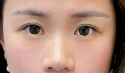 -杭州米兰柏羽医疗美容医院