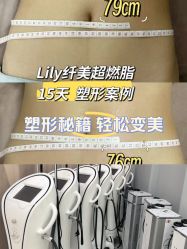 -Lily纤美·科技减脂中心