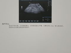 -济南艾玛体检中心