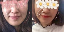 -依萱绮医疗美容
