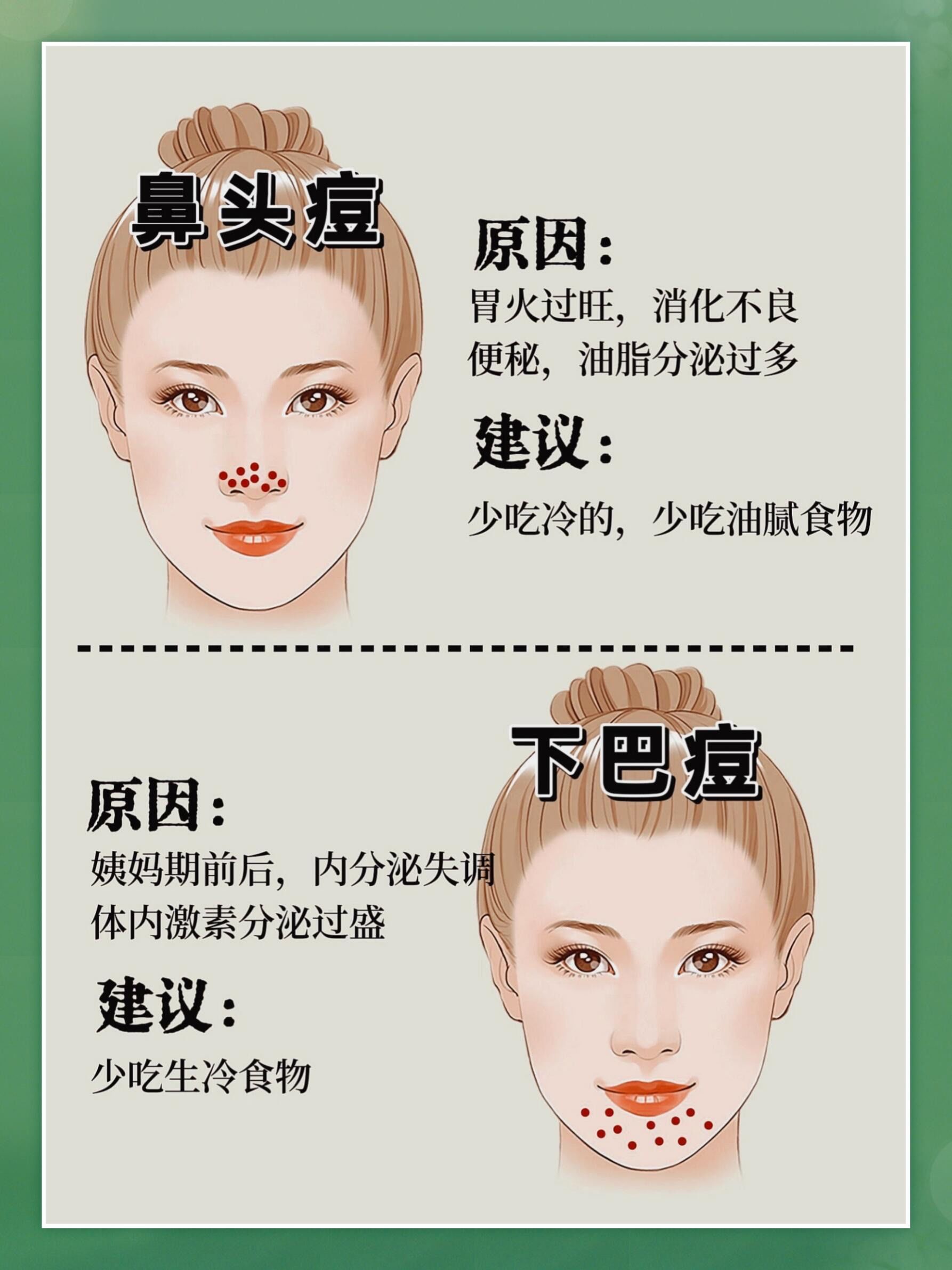 n	
脸上不同部位长痘反馈的身体状态不同
对症调理,痘痘消的